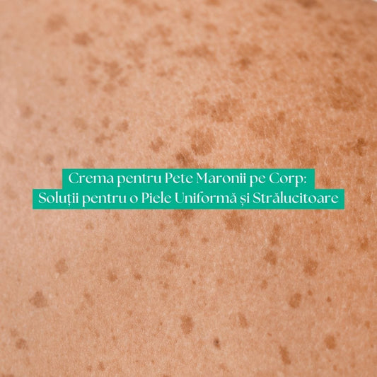 Crema pentru Pete Maronii pe Corp: Soluții pentru o Piele Uniformă și Strălucitoare