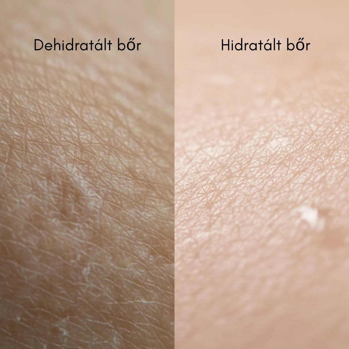 Quattro Hydra+ krém kollagénnel és 4 féle hialuronsavval, 50 ml