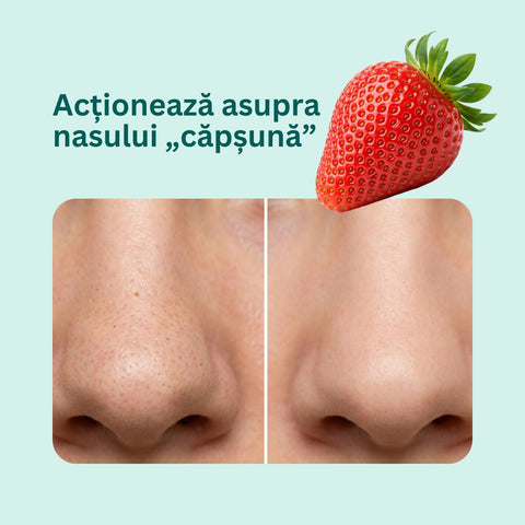 MicroDerm arclemosó és bőrradír, 50 ml