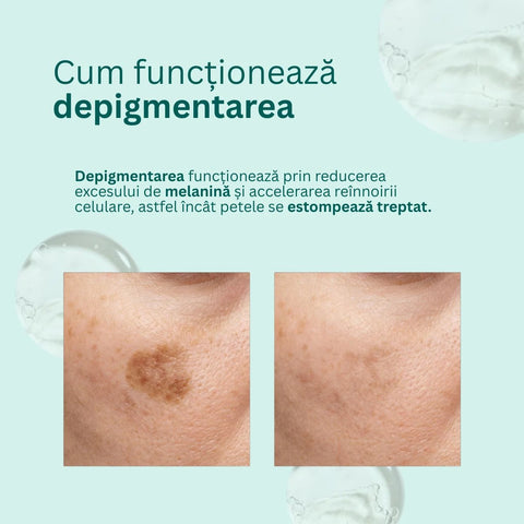 Esti noapte pentru reducerea petelor maronii